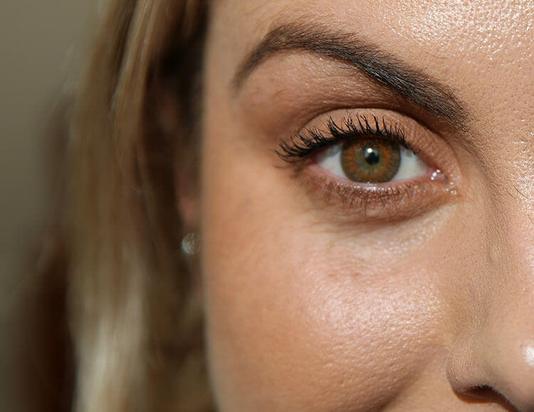 Contact Lenses Contact Lenses Pezzimenti Nixon Optometrists