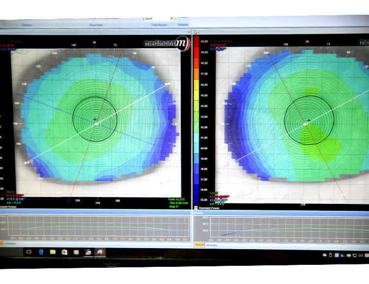 Pezzimenti Nixon Optometrists Technology Pezzimenti Nixon Optometrists Technology